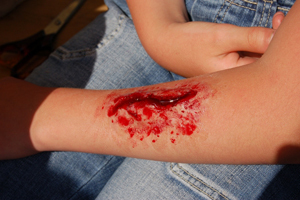 Jaarlijks 12.000 gewonden in de horeca