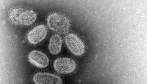 Stuur grieperige medewerkers direct naar huis