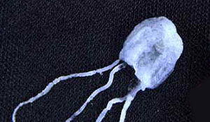 Winnaar droombaan gestoken door giftige kwal